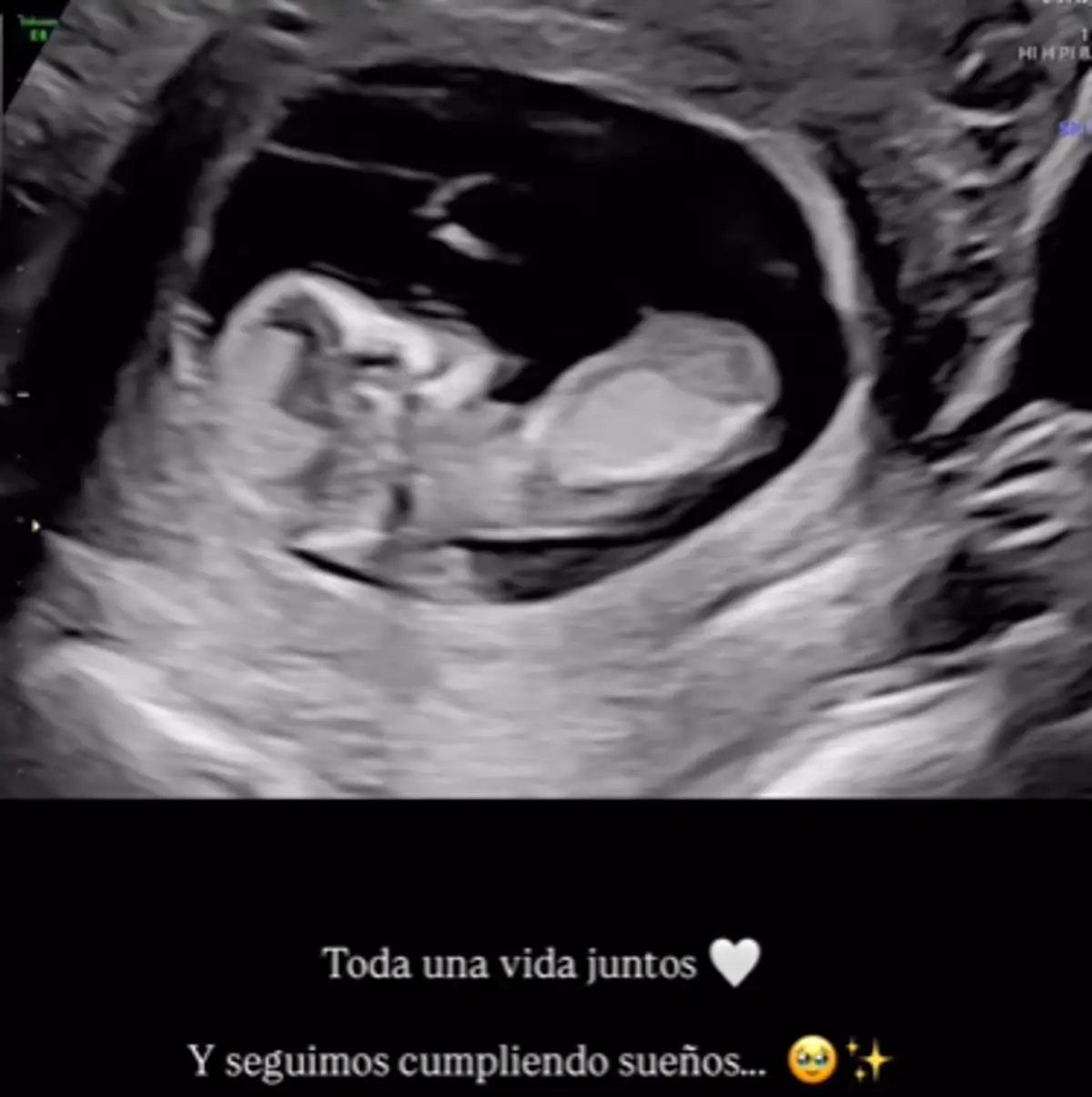 Bebé de Candela Cruz 